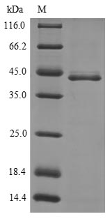 (Tris-Glycine gel) Discontinuous SDS-PAGE (reduced) with 5% enrichment gel and 15% separation gel.